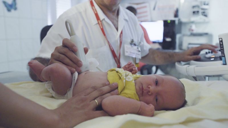 Újraindul a csecsemő ultrahang szűrés